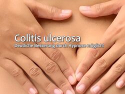 Colitis ulcerosa