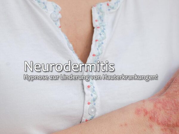 Neurodermitis: Hypnose zur Linderung von Hauterkrankungen!